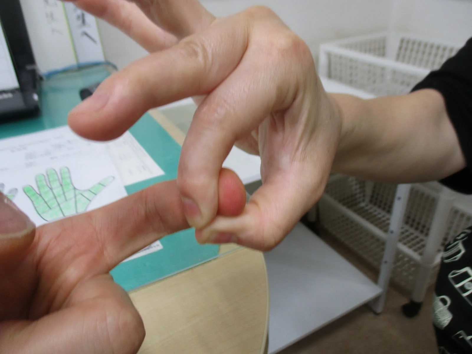 中指と示指を手術していますので、その2本を試しています。つまむ動作はこの2本と親指の仕事ですので大切ですね。
